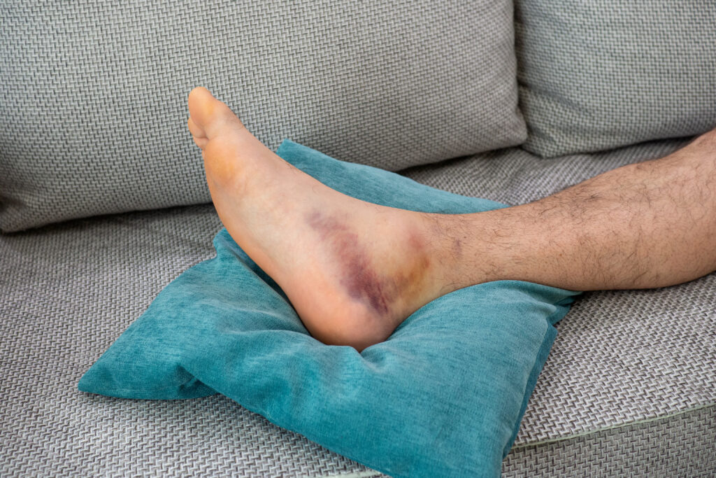 Common cricket injuries by body area — knee, ankle, shoulder.